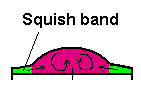 squish band